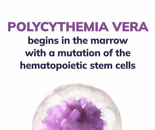 Polycythemia